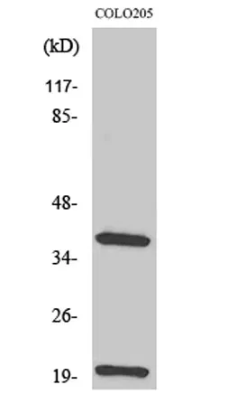 TCR β rabbit pAb