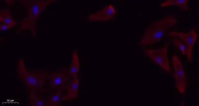 TGFβ RI rabbit pAb - image 1