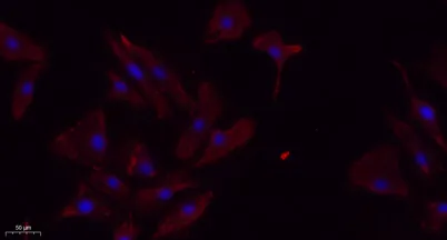 TGFβ RII rabbit pAb - image 1
