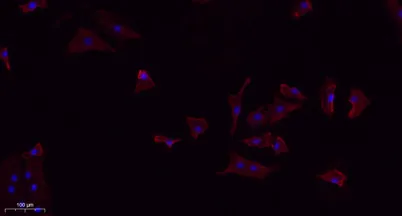 TGFβ1 rabbit pAb