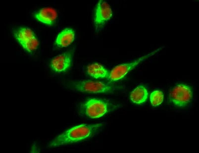 Tyrosine Hydroxylase rabbit pAb - image 1