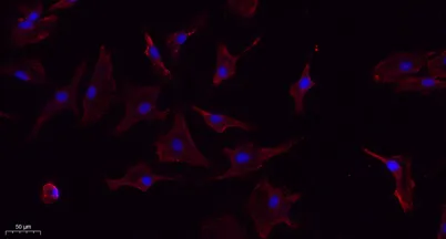 TNF-α rabbit pAb - image 1