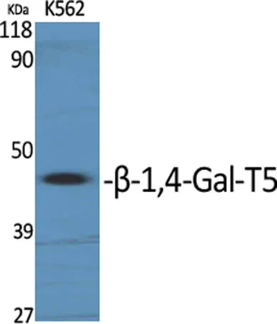 β-1,4-Gal-T5 rabbit pAb - image 1