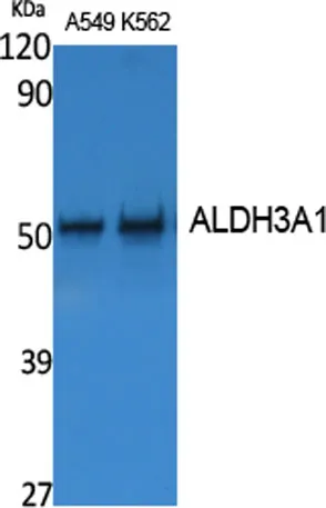 ALDH3A1 rabbit pAb - image 1