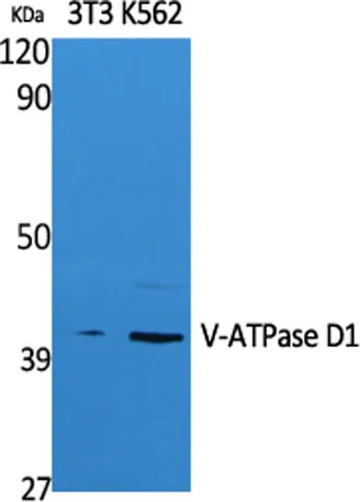 V-ATPase D1 rabbit pAb - image 1
