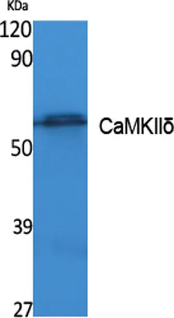 CaMKIIδ rabbit pAb - image 1