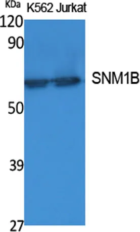 SNM1B rabbit pAb - image 1