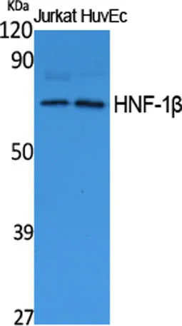 HNF-1β rabbit pAb - image 1