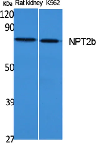 NPT2b rabbit pAb