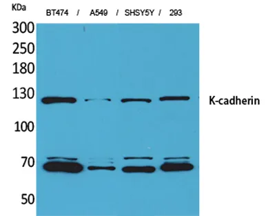 K-cadherin rabbit pAb - image 1