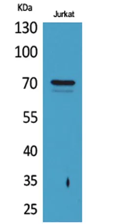 Prothrombin rabbit pAb - image 1