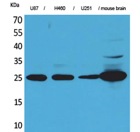 UCH-L1 rabbit pAb - image 1