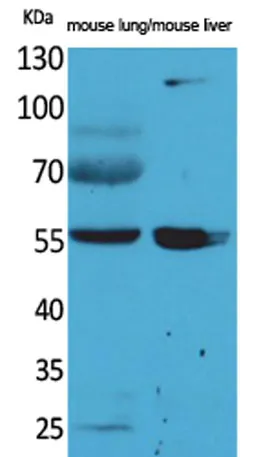 ALDH1A1 rabbit pAb - image 1