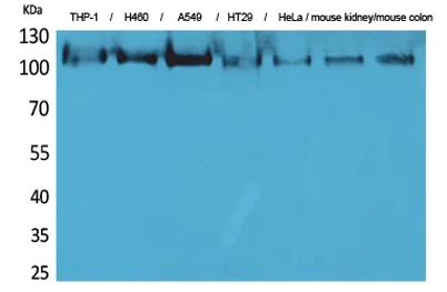 cPLA2 rabbit pAb - image 1