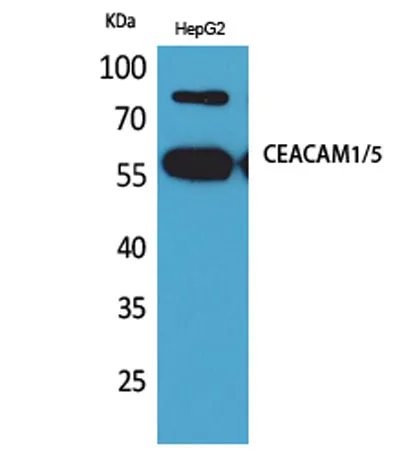 CEACAM1/5 rabbit pAb - image 1