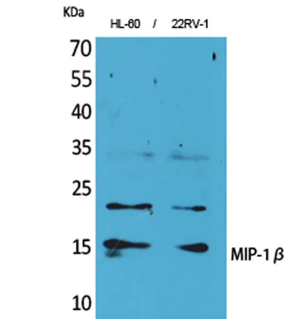 MIP-1β rabbit pAb - image 1