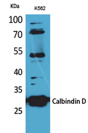 Calbindin D28K rabbit pAb - image 1
