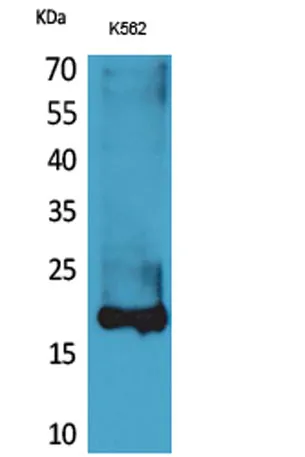 Lipocalin-1 rabbit pAb - image 1