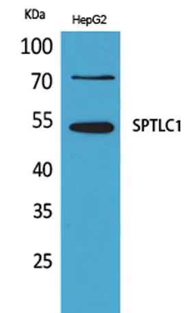SPTLC1 rabbit pAb - image 1