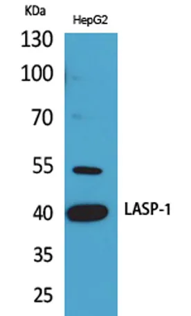 LASP-1 rabbit pAb - image 1