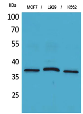 CD79b rabbit pAb - image 1