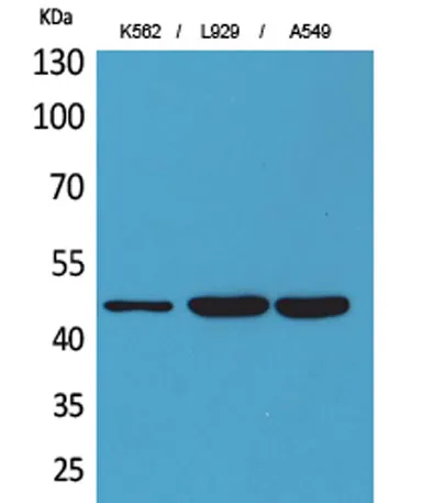 CD158z rabbit pAb