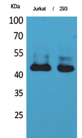 SCCA1/2 rabbit pAb - image 1