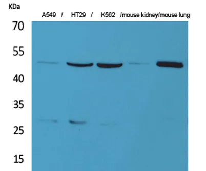 GDI-2 rabbit pAb - image 1