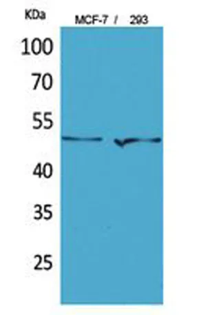PD-ECGF rabbit pAb - image 1