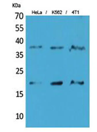 STING/TMEM173 rabbit pAb - image 1