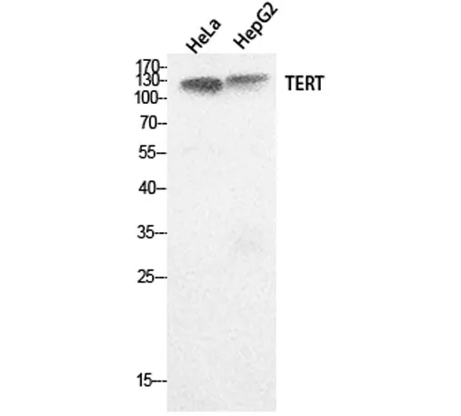 TERT rabbit pAb - image 1