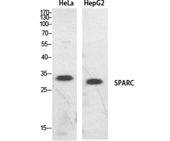 SPARC rabbit pAb - image 1