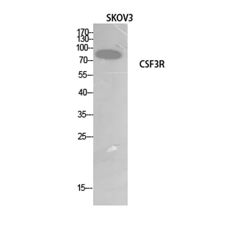 G-CSFR rabbit pAb - image 1
