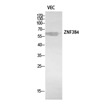 ZNF384 rabbit pAb - image 1