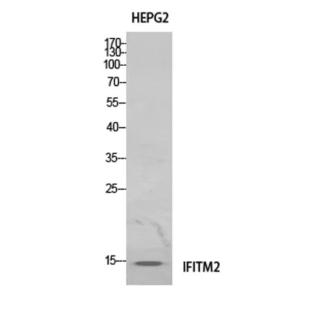 IFITM2 rabbit pAb - image 1