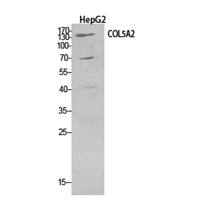 COL5A2 rabbit pAb - image 1