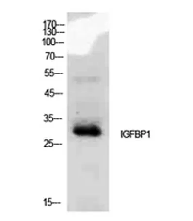 IGFBP1 rabbit pAb - image 1