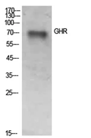 GHR rabbit pAb