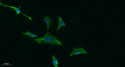 CD155 rabbit pAb - image 1
