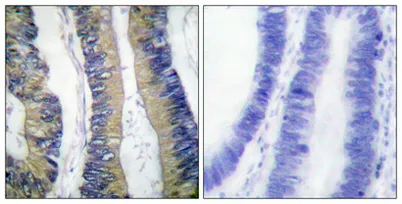 4E-BP1 (phospho Thr69) rabbit pAb - image 1