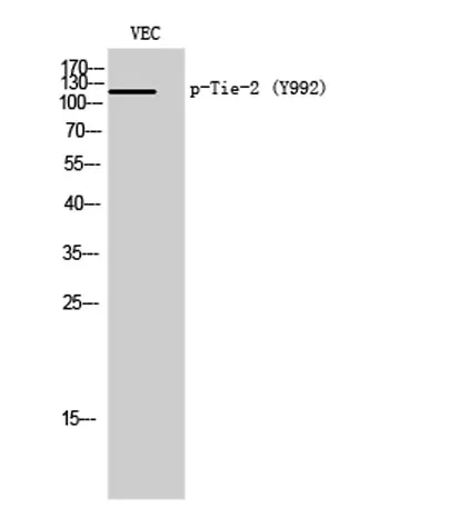 Tie-2 (phospho Tyr992) rabbit pAb - image 1
