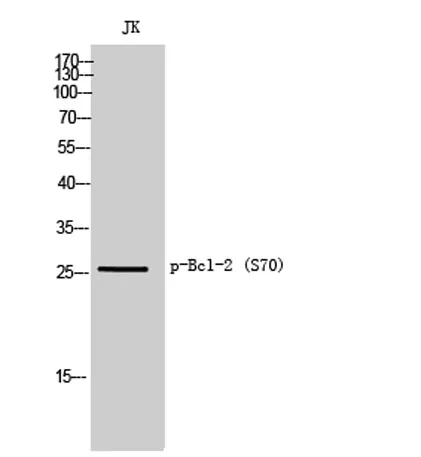 Bcl-2 (phospho Ser70) rabbit pAb - image 1