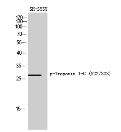 Troponin I-C (phospho Ser22/S23) rabbit pAb - image 1