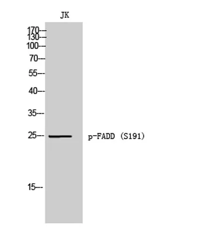 FADD (phospho Ser191) rabbit pAb - image 1