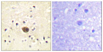 Ras-GRF1 rabbit pAb - image 1