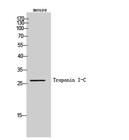Troponin I-C rabbit pAb - image 1