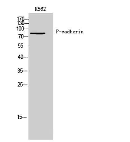 P-cadherin rabbit pAb - image 1