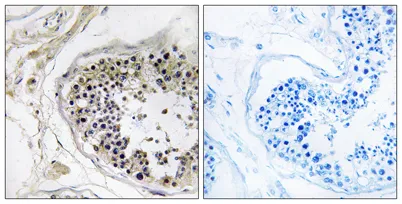 Cystatin 8 rabbit pAb - image 1