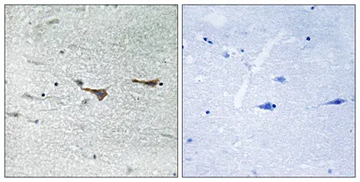 TOB1 rabbit pAb - image 1