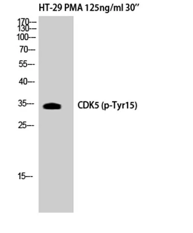 Cdk5 (phospho Tyr15) rabbit pAb - image 1